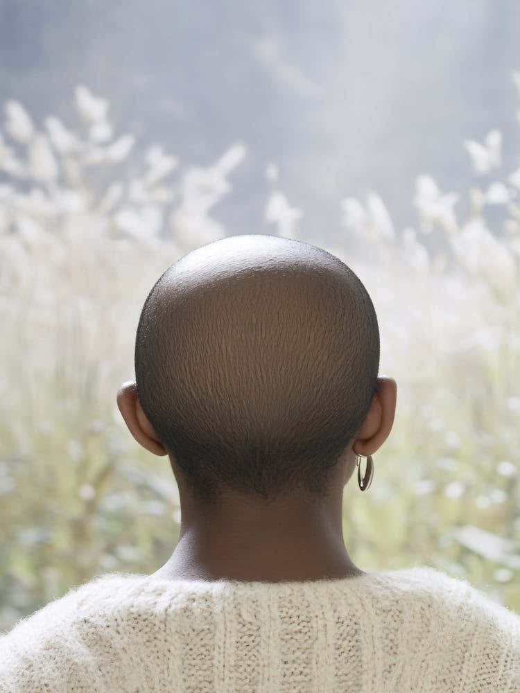 Back View Of A Woman With Bald Head