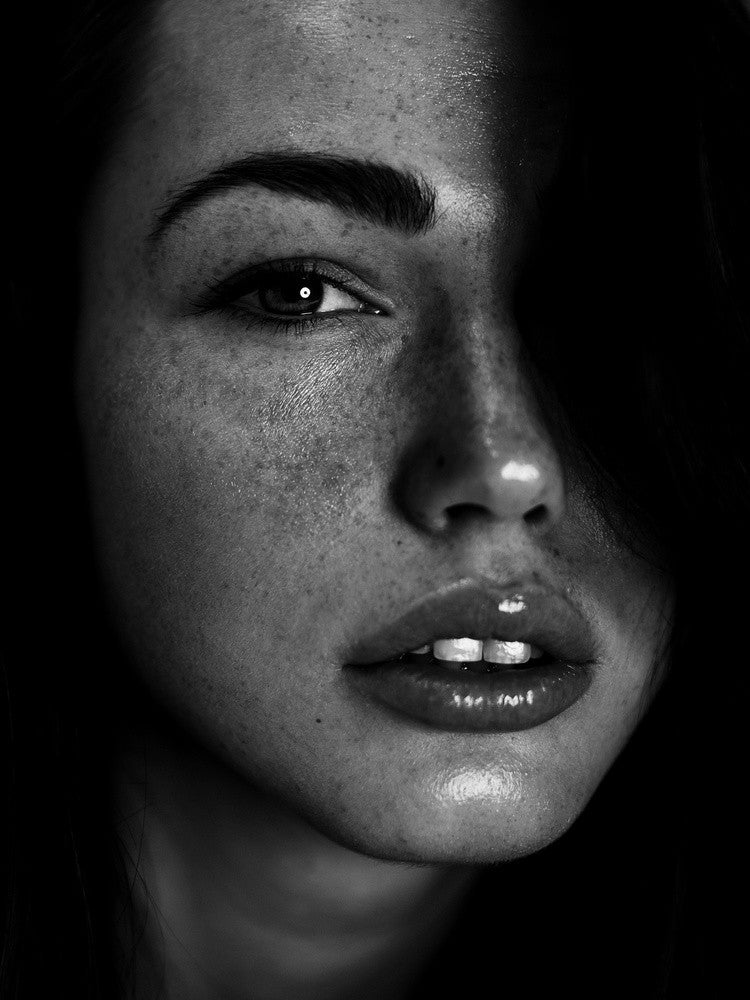 Freckles [Romi]