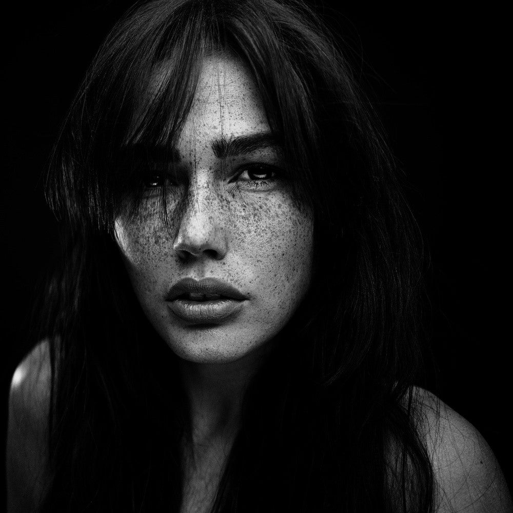 Freckles [Romi]