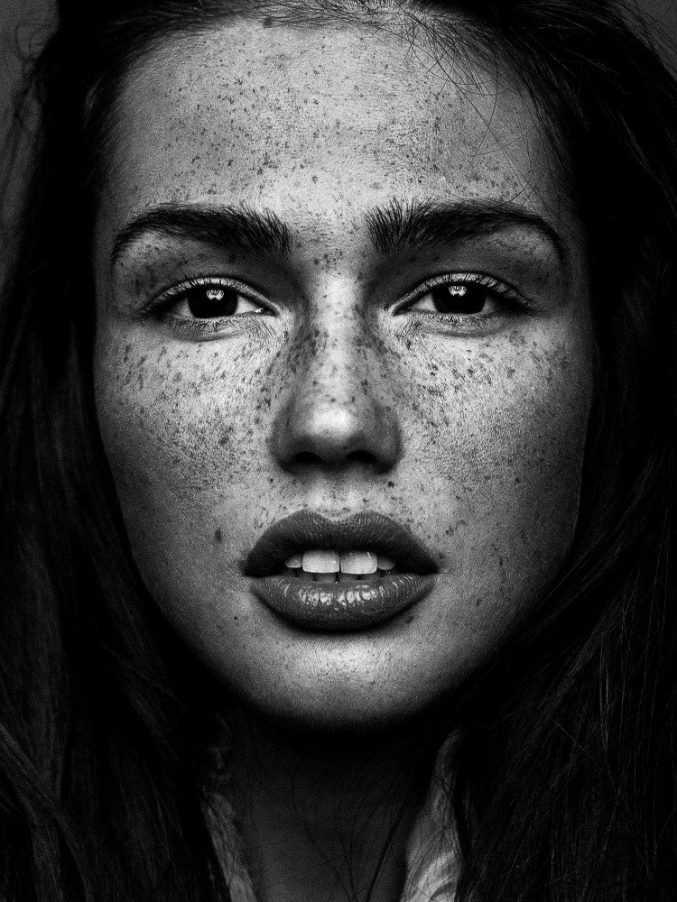 Freckles beauty