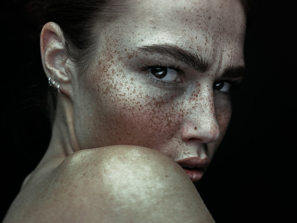 Freckles beauty