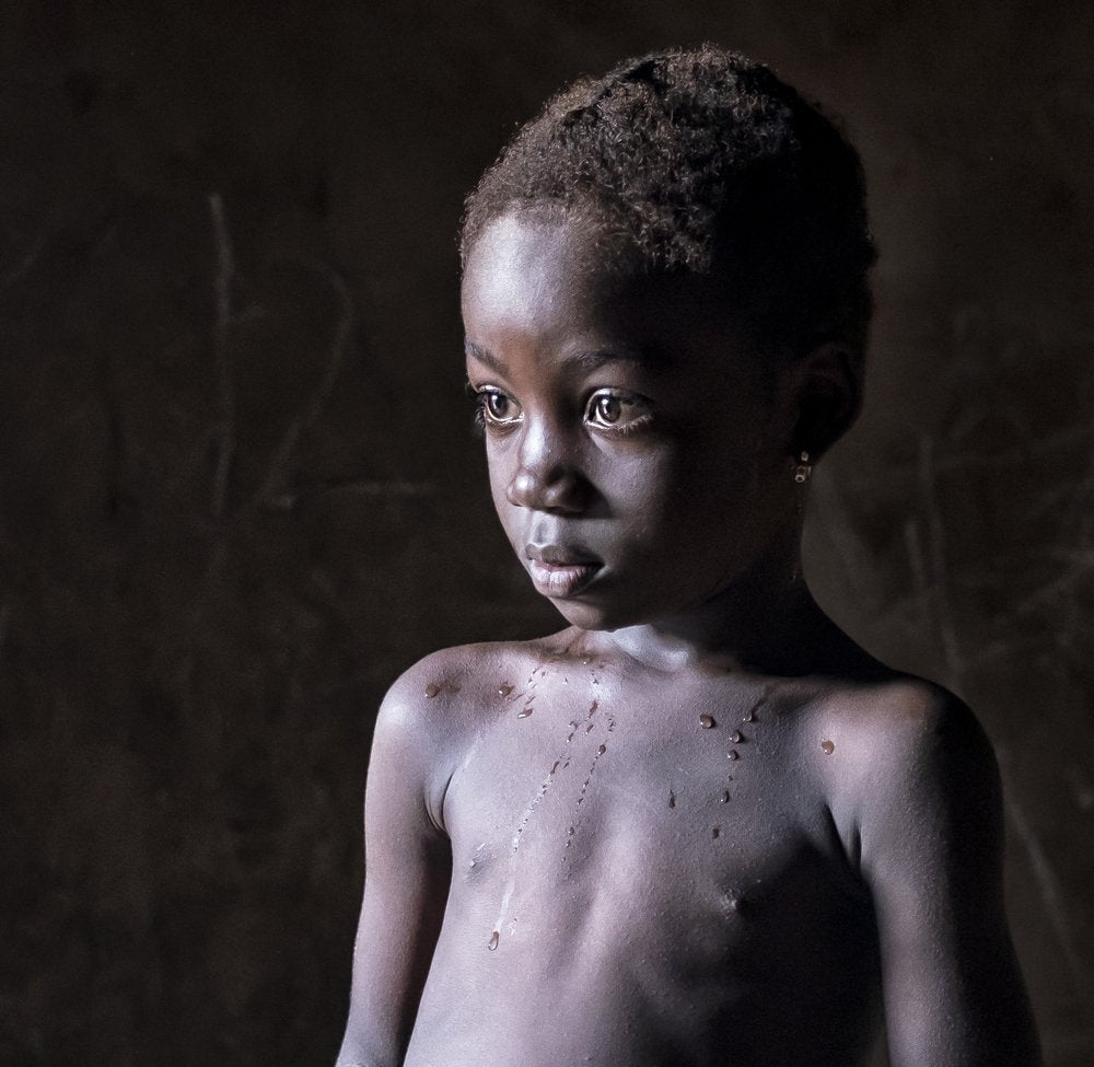 Pensive African Child