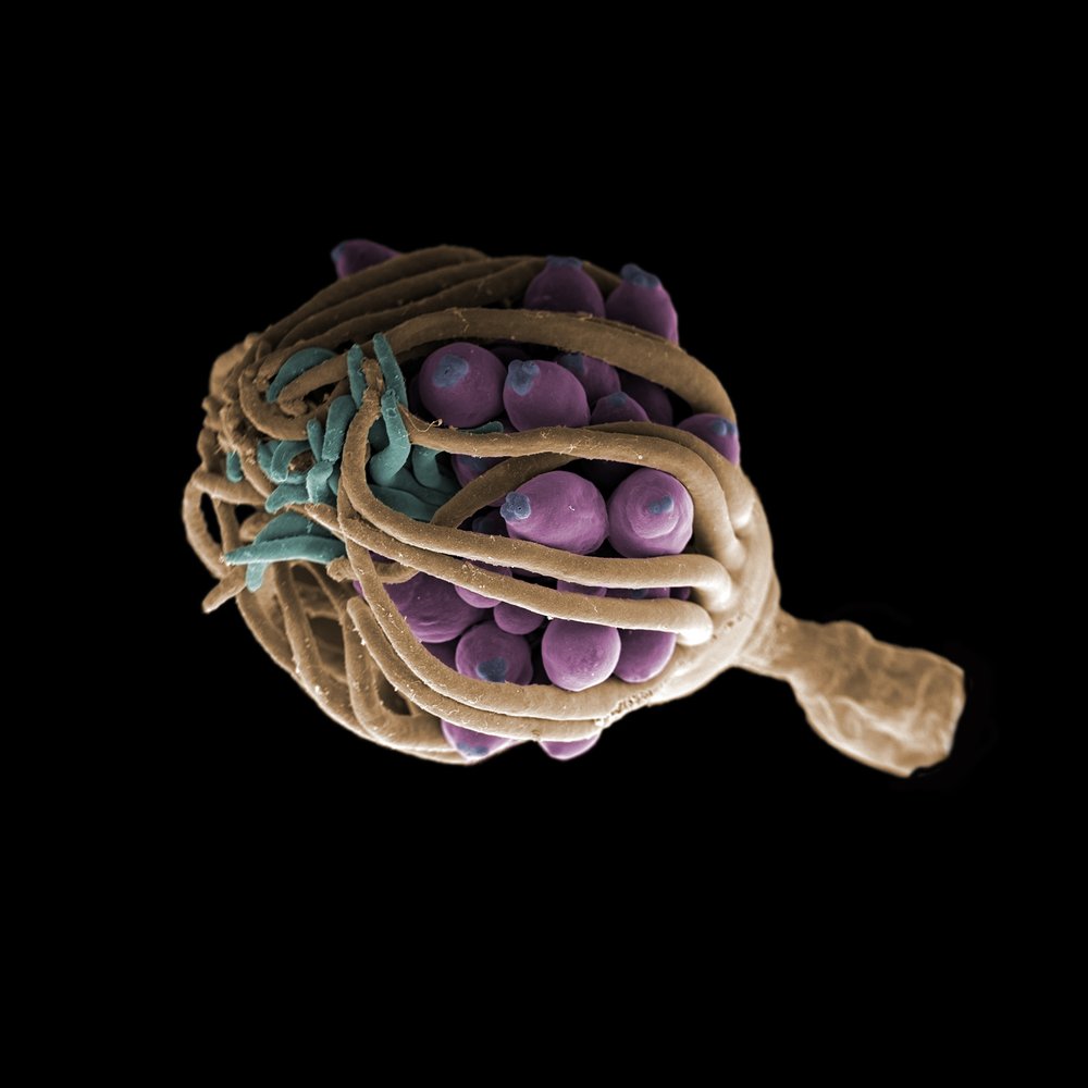 Microscopic Fungal Spores