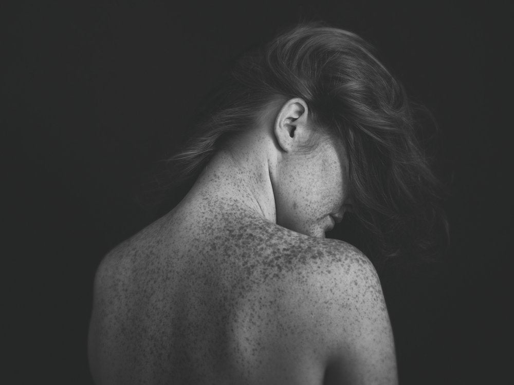 Freckled Skin Portrait