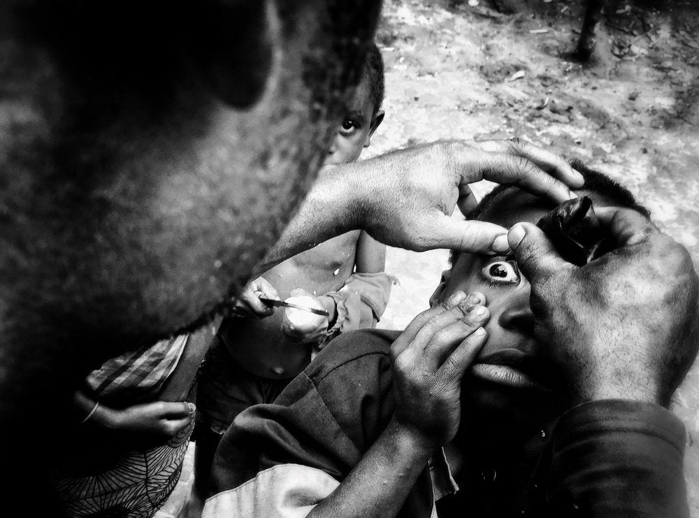 Protecting a Child's Sight