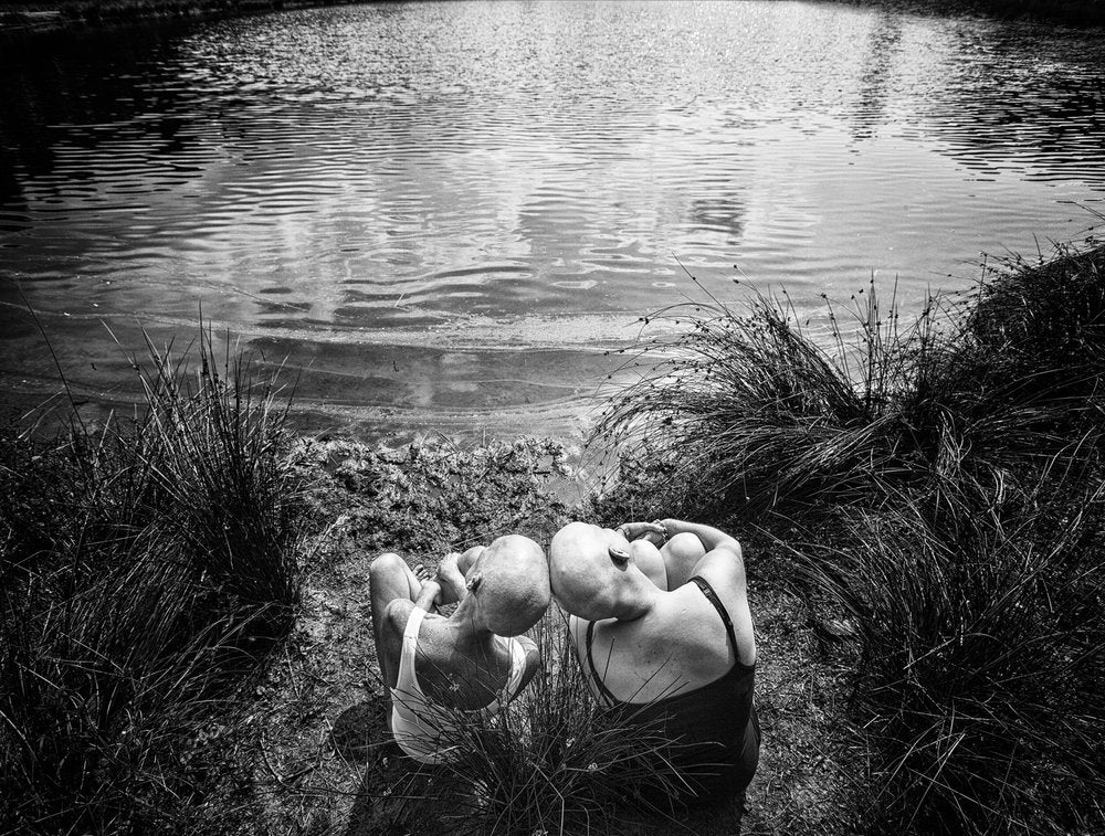 Two Bald Women Lakeside