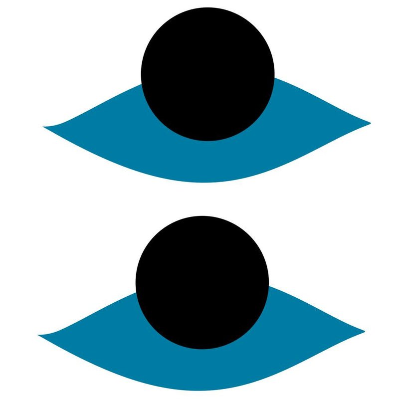 Blue Eyes With Black Dots