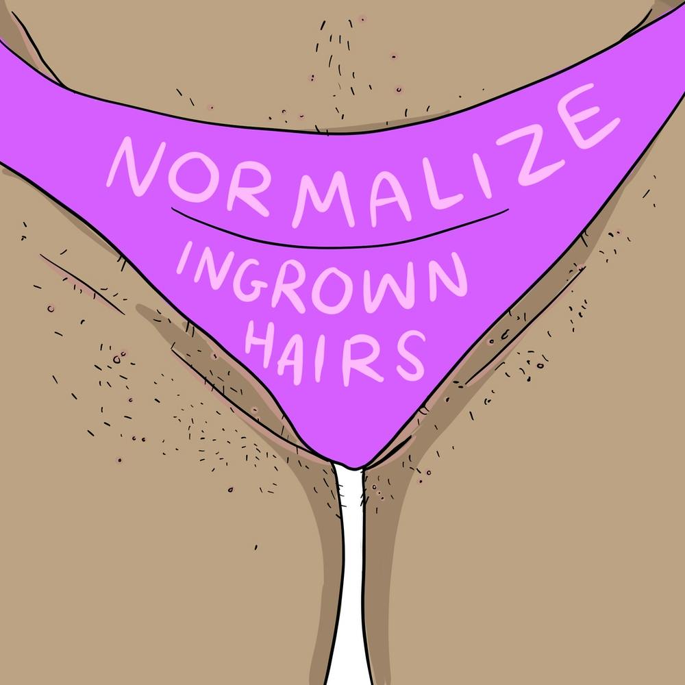 Eingewachsene Haare normalisieren