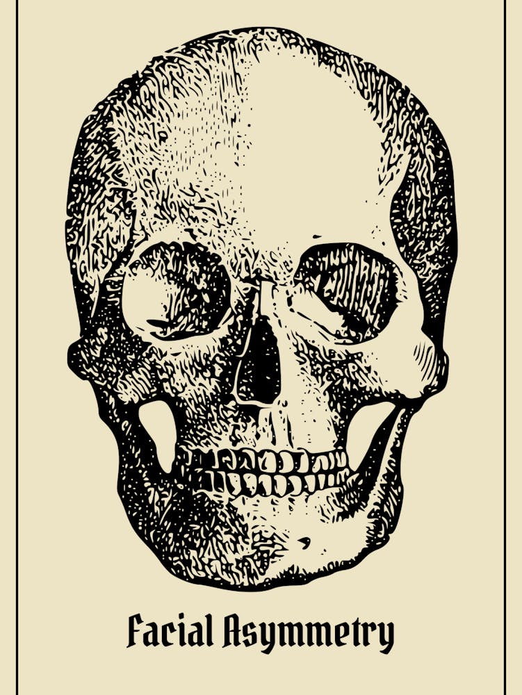 Facial Asymmetry Skull