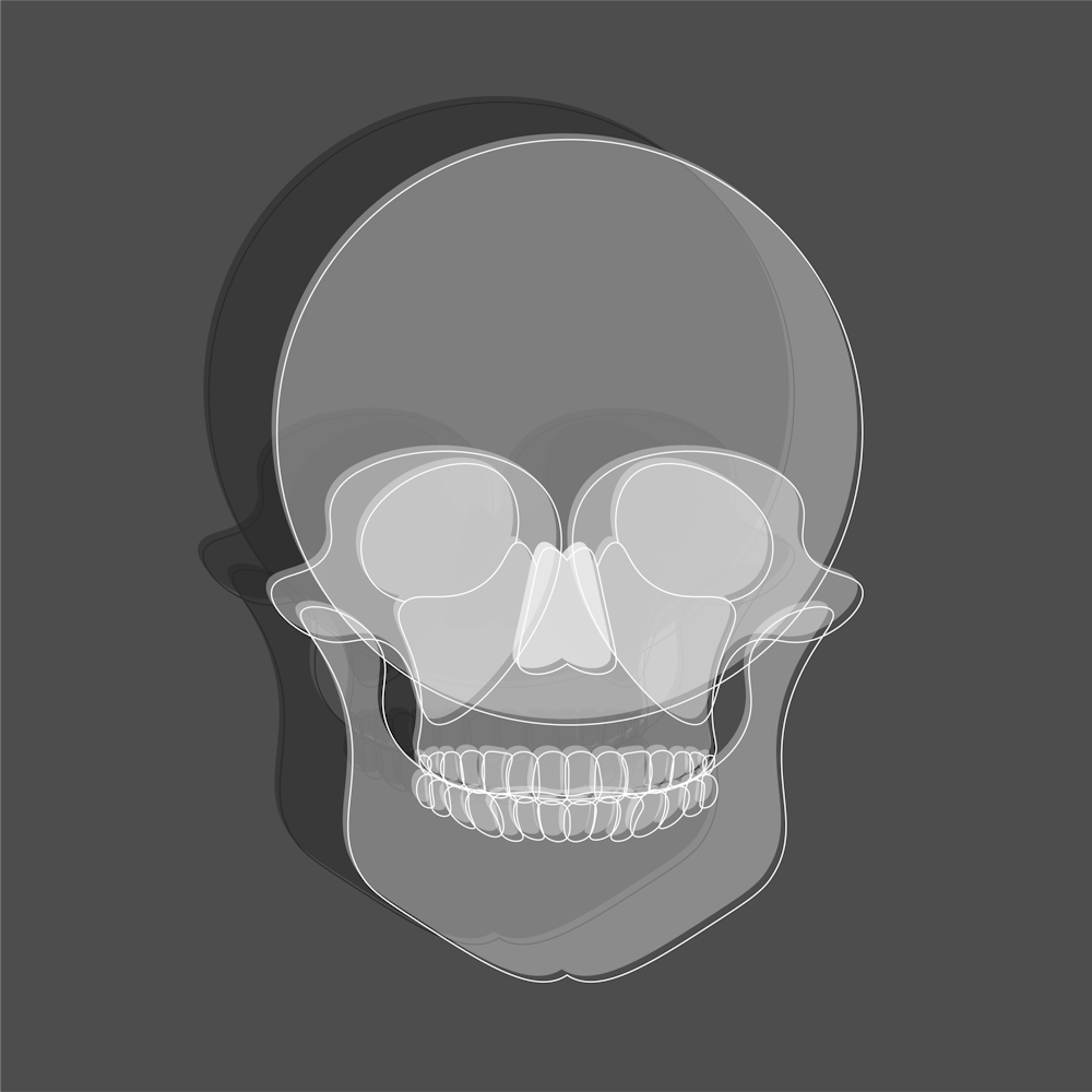 Human Skull