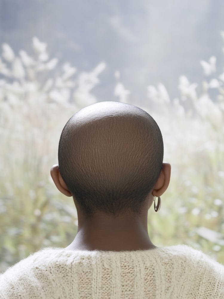 Back View Of A Woman With Bald Head