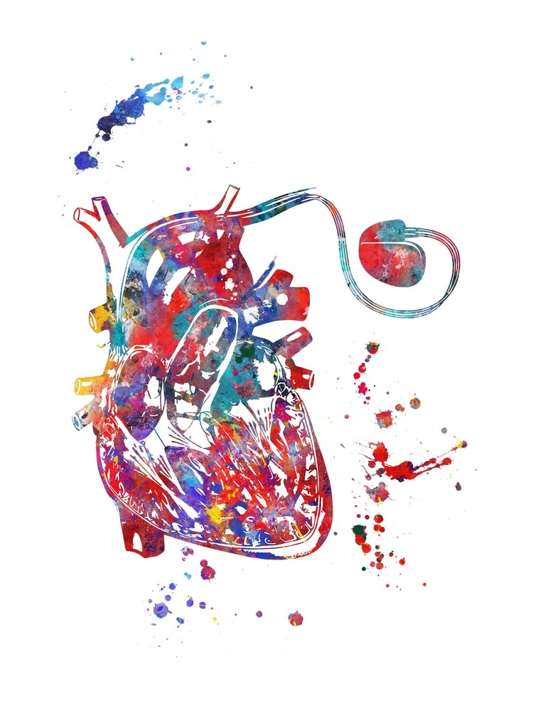 Heart Pacemaker Watercolor
