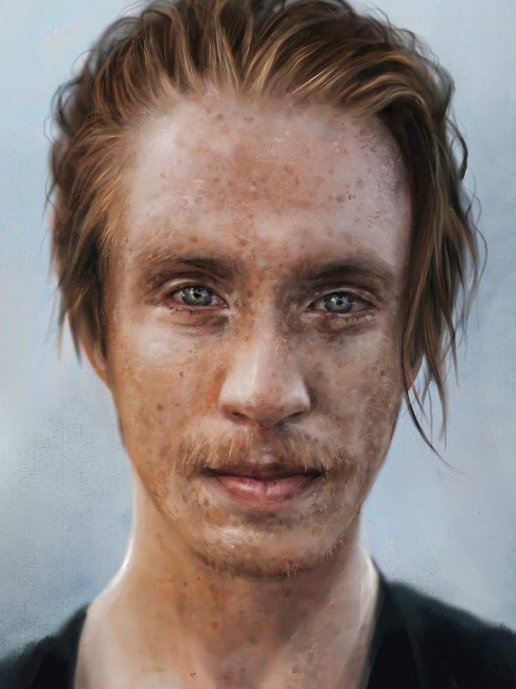 Freckles